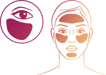 Melasma, hipercromia e manchas